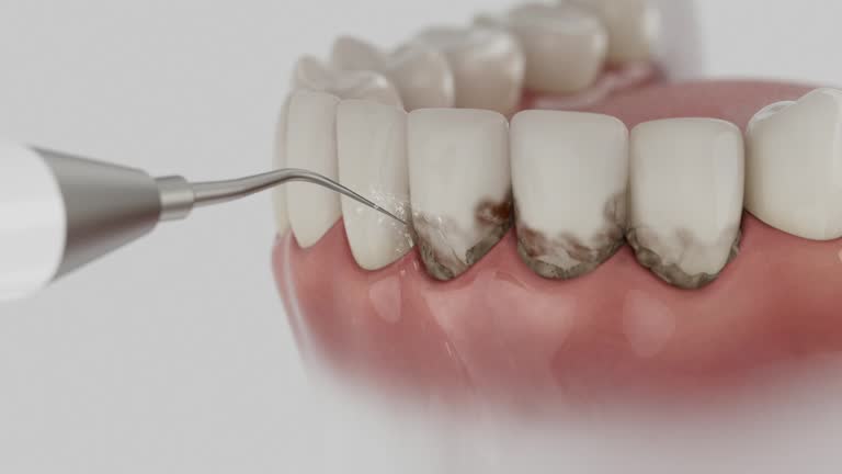 Trusted Teeth Cleaning And Checkup service in Merlin, OR - Dentist Open Now